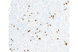 Immunohistochemistry (IHC) image for anti-Chemokine (C-X3-C Motif) Receptor 1 (CX3CR1) (AA 300-350) antibody (ABIN7795801) (Rekombinanter CX3CR1 Antikörper  (AA 300-350))