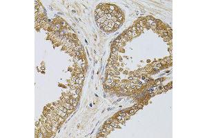 Immunohistochemistry of paraffin-embedded human prostate using TEFM antibody (ABIN5974873) at dilution of 1/100 (40x lens). (TEFM Antikörper)