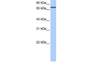 WB Suggested Anti-ADAD2 Antibody Titration:  0. (ADAD2 Antikörper  (C-Term))