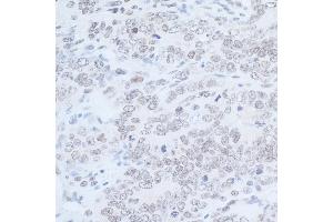 Immunohistochemistry (IHC) image for anti-Rad6 (N-Term) antibody (ABIN7449403) (Rad6 (N-Term) Antikörper)