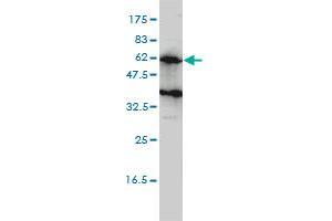 KIRREL2 monoclonal antibody (M01), clone 2B9-1D3 Western Blot analysis of KIRREL2 expression in Hela S3 NE . (KIRREL2 Antikörper  (AA 1-219))