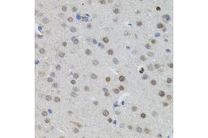 Immunohistochemistry of paraffin-embedded mouse brain using MYCN antibody.
