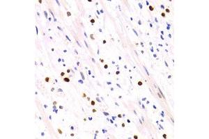 Immunohistochemistry of paraffin-embedded human vermiform appendix using GEMIN2 Antibody. (SIP1 Antikörper)
