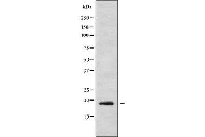 Western blot analysis of MRPL30 using HeLa whole cell lysates (MRPL30 Antikörper  (Internal Region))