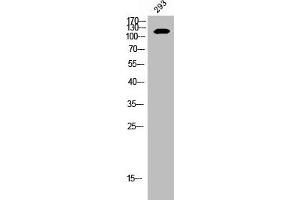 Western Blot analysis of 293 cells using EphB2 Polyclonal Antibody (EPH Receptor B2 Antikörper  (C-Term))