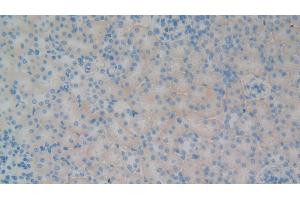 Detection of GP1BB in Rat Kidney Tissue using Polyclonal Antibody to Platelet Glycoprotein Ib Beta Chain (GP1BB) (GP1BB Antikörper  (AA 52-164))
