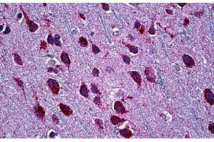 Human Brain, Cortex: Formalin-Fixed, Paraffin-Embedded (FFPE) (SMARCD2 Antikörper  (AA 398-475))