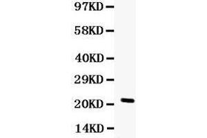 Observed bind size: 22KD (G-CSF Antikörper  (AA 47-208))