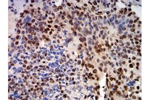 Immunohistochemistry (IHC) image for anti-Cold Inducible RNA Binding Protein (CIRBP) (AA 1-90) antibody (ABIN5542478)