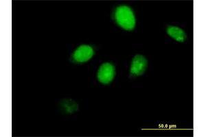 Immunofluorescence (IF) image for anti-Runt-Related Transcription Factor 3 (RUNX3) (AA 1-429) antibody (ABIN514065)