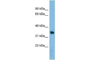 WB Suggested Anti-NSMCE1 Antibody Titration: 0. (NSMCE1 Antikörper  (Middle Region))