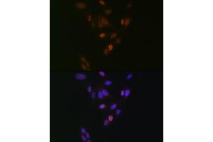 Immunofluorescence analysis of U-2 OS cells using NUP153 Rabbit mAb (ABIN1512527, ABIN3023298, ABIN3023299 and ABIN7101477) at dilution of 1:100 (40x lens).