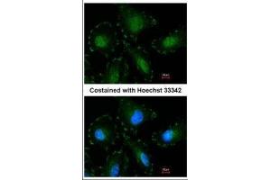 ICC/IF Image Immunofluorescence analysis of paraformaldehyde-fixed HeLa, using Calpain-5, antibody at 1:100 dilution. (Calpain 5 Antikörper)