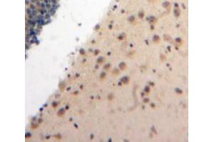 Used in DAB staining on fromalin fixed paraffin-embedded Brain tissue (ATR Antikörper  (AA 2353-2644))
