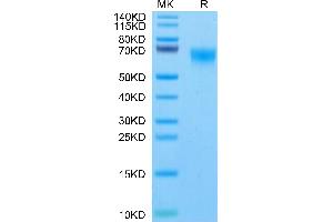 Rhesus macaque FGFR4 on Tris-Bis PAGE under reduced condition. (FGFR4 Protein (AA 22-369) (His tag))