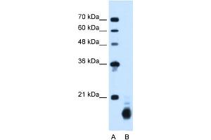 WB Suggested Anti-PPIB Antibody Titration:  1. (PPIB Antikörper  (C-Term))