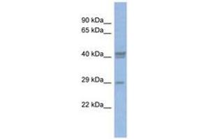 Image no. 1 for anti-CCAAT/enhancer Binding Protein (C/EBP), delta (CEBPD) (C-Term) antibody (ABIN6742779) (CEBPD Antikörper  (C-Term))