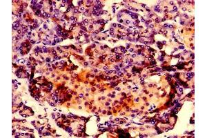 Immunohistochemistry of paraffin-embedded human pancreatic tissue using ABIN7167217 at dilution of 1:100 (RAB1A Antikörper  (AA 1-196))