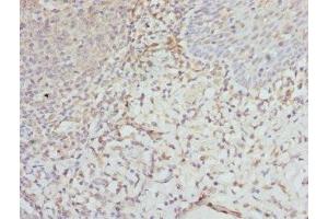 Immunohistochemistry (IHC) image for anti-Eukaryotic Translation Initiation Factor 2, Subunit 3 Gamma, 52kDa (EIF2S3) (AA 173-472) antibody (ABIN7152135)