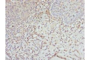 Immunohistochemistry of paraffin-embedded human tonsil tissue using ABIN7152135 at dilution of 1:100 (EIF2S3 Antikörper  (AA 173-472))