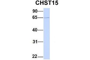 Host:  Rabbit  Target Name:  CHST15  Sample Type:  MCF7  Antibody Dilution:  1. (CHST15 Antikörper  (Middle Region))