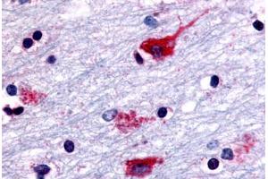 Anti-CHRM2 antibody  ABIN1048440 IHC staining of human brain, neurons and glia.