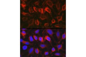 Immunofluorescence analysis of HeLa cells using G6PD Rabbit pAb (ABIN3022094, ABIN3022095, ABIN3022096 and ABIN6218601) at dilution of 1:100 (40x lens). (Glucose-6-Phosphate Dehydrogenase Antikörper  (AA 246-545))