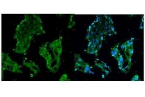 IHC analysis of RCC1 using anti-RCC1 antibody (ABIN7600024).