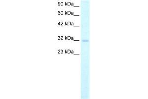 WB Suggested Anti-MSX1 Antibody Titration: 2. (MSX1 Antikörper  (Middle Region))