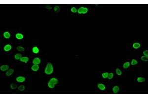 Immunofluorescent analysis of Hela cells using ABIN7139668 at dilution of 1:100 and Alexa Fluor 488-congugated AffiniPure Goat Anti-Rabbit IgG(H+L) (HIST1H3A Antikörper  (3meLys27))