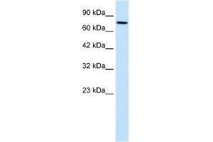 WHSC1 antibody used at 1. (WHSC1 Antikörper  (N-Term))