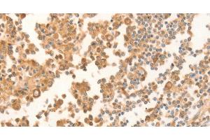 Immunohistochemistry of paraffin-embedded Human tonsil using NAP1L1 Polyclonal Antibody at dilution of 1:70