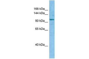WB Suggested Anti-WWC1 Antibody Titration: 1. (WWC1 Antikörper  (C-Term))