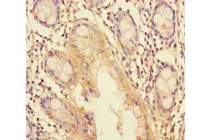 Immunohistochemistry of paraffin-embedded human colon tissue using ABIN7151266 at dilution of 1:100 (TRIM37 Antikörper  (AA 301-600))
