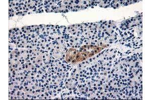 Immunohistochemical staining of paraffin-embedded Human pancreas tissue using anti-TBC1D21 mouse monoclonal antibody. (TBC1D21 Antikörper)