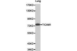 Western Blotting (WB) image for anti-Toll-Like Receptor Adaptor Molecule 1 (TICAM1) antibody (ABIN1875095) (TICAM1 Antikörper)
