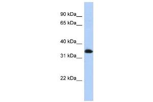 WB Suggested Anti-ZNF511 Antibody Titration:  0. (ZNF511 Antikörper  (N-Term))