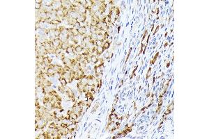 Immunohistochemistry (IHC) image for anti-Bone Morphogenetic Protein Receptor, Type IB (BMPR1B) (AA 1-126) antibody (ABIN3022720)