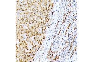 Immunohistochemistry of paraffin-embedded rat ovary using BMPR1B Rabbit pAb (ABIN3022719, ABIN3022720, ABIN3022721, ABIN1512645 and ABIN6219169) at dilution of 1:350 (40x lens). (BMPR1B Antikörper  (AA 1-126))
