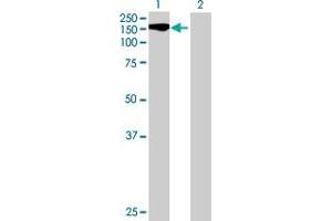 Western Blotting (WB) image for STK11IP 293T Cell Transient Overexpression Lysate(Denatured) (ABIN1338480)