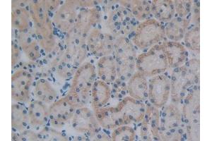 Immunohistochemistry (IHC) image for anti-Pre-B Lymphocyte 1 (VPREB1) (AA 43-128) antibody (ABIN2119232)