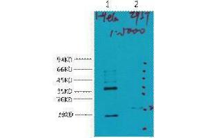 Western Blotting (WB) image for anti-Carbonic Anhydrase IX (CA9) antibody (ABIN3181146) (CA9 Antikörper)