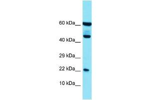 Host: Rabbit Target Name: PLA2G12B Sample Type: HT1080 Whole Cell lysates Antibody Dilution: 1. (PLA2G12B Antikörper  (N-Term))