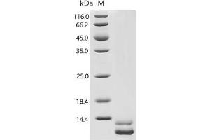 (Tris-Glycine gel) Discontinuous SDS-PAGE (reduced) with 5 % enrichment gel and 15 % separation gel.