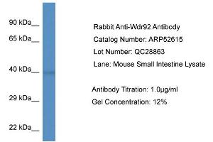 Western Blotting (WB) image for anti-WD Repeat Domain 92 (WDR92) (Middle Region) antibody (ABIN2785012)