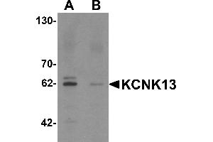 Western blot analysis of KCNK13 in rat brain tissue lysate with KCNK13 antibody at 0.