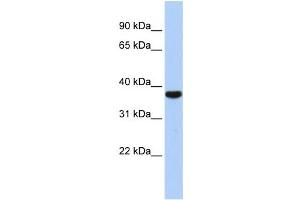 Western Blotting (WB) image for anti-Exosome Component 2 (EXOSC2) antibody (ABIN2458529) (EXOSC2 Antikörper)