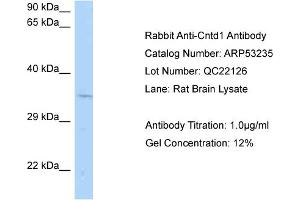 Western Blotting (WB) image for anti-Cyclin N-terminal Domain Containing 1 (CNTD1) (Middle Region) antibody (ABIN2785305) (CNTD1 Antikörper  (Middle Region))