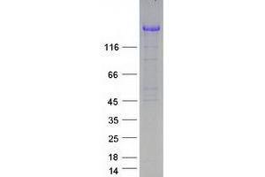 UBE2O Protein (Myc-DYKDDDDK Tag)