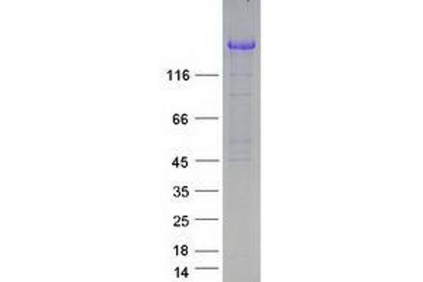 UBE2O Protein (Myc-DYKDDDDK Tag)